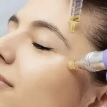 Level 4 Certificate in Skin Needling Treatments (RFQ)